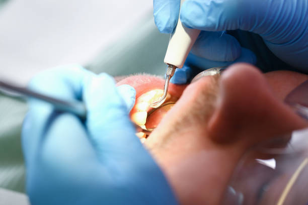 Best Emergency Denture Repair in Harbor Bluffs, FL