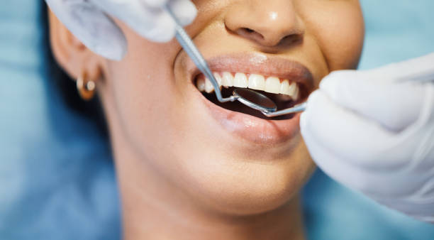 Best Urgent Care for Lost Fillings or Crowns in Harbor Bluffs, FL
