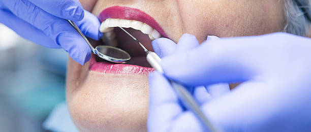 Best Emergency Dental Care for Broken or Chipped Teeth in Harbor Bluffs, FL